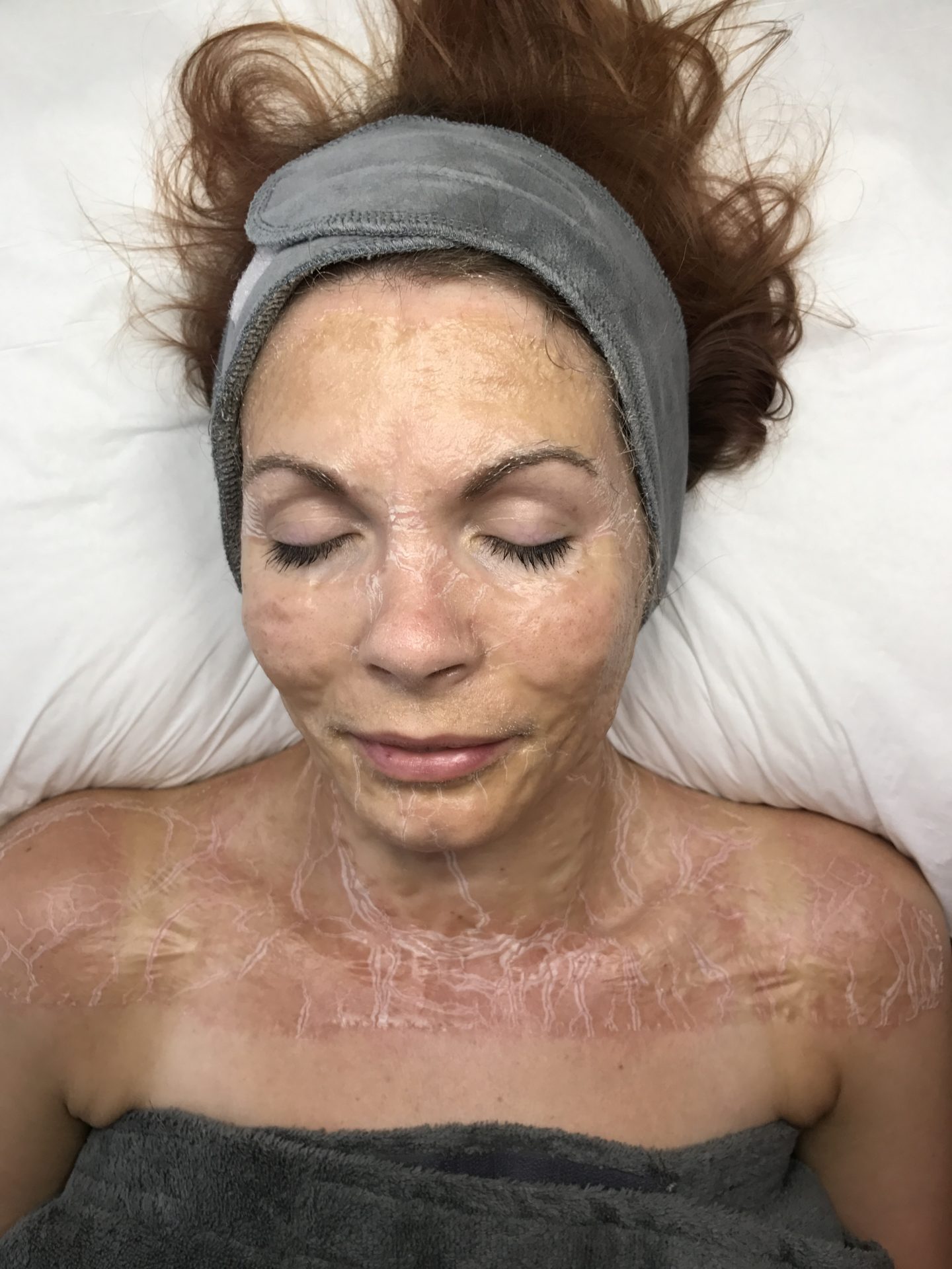 DMK Enzyme Therapy Facial Skin Aspirations